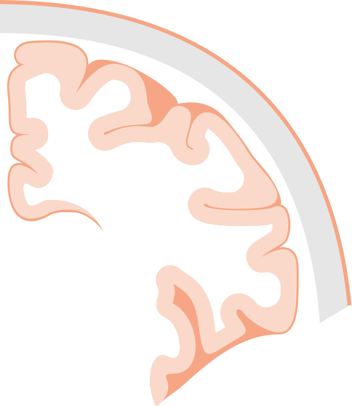 Brain coronal slice
