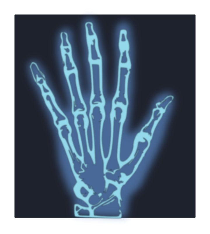 Hand X-ray