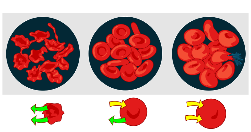 Osmotic pressure on blood cells