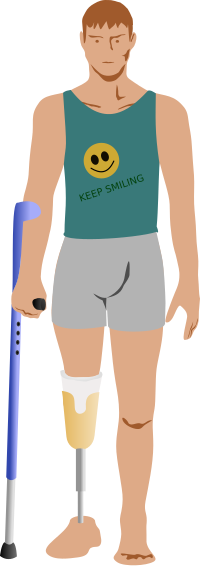 Man after amputation