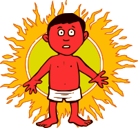 Sunburn - Man