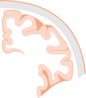 Brain coronal slice