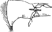 tourniquet