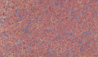 Marbled pattern 3