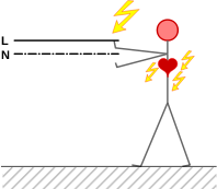 electric shock