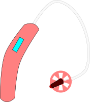 Hearing Aid