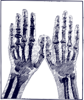 X-ray Image