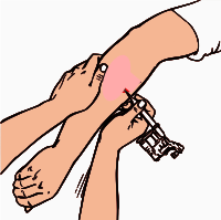 Getting An Arm Tattoo (Remix)