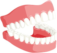 Teeth By kreatikar