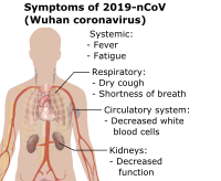 Wuhan virus symptoms