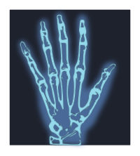 Hand X-ray