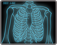 Chest X-ray