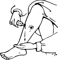 Ulcer or Running Sore