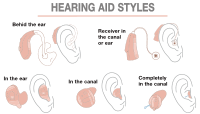 Hearing Aid Styles