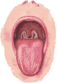 Mouth Open