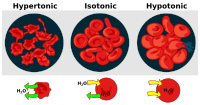 Osmotic pressure on blood cells