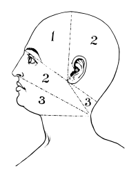 Divided Head Diagram