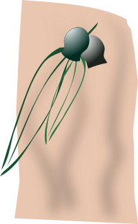 gumleaves