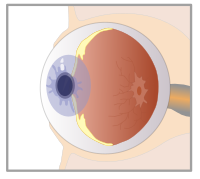 eye
