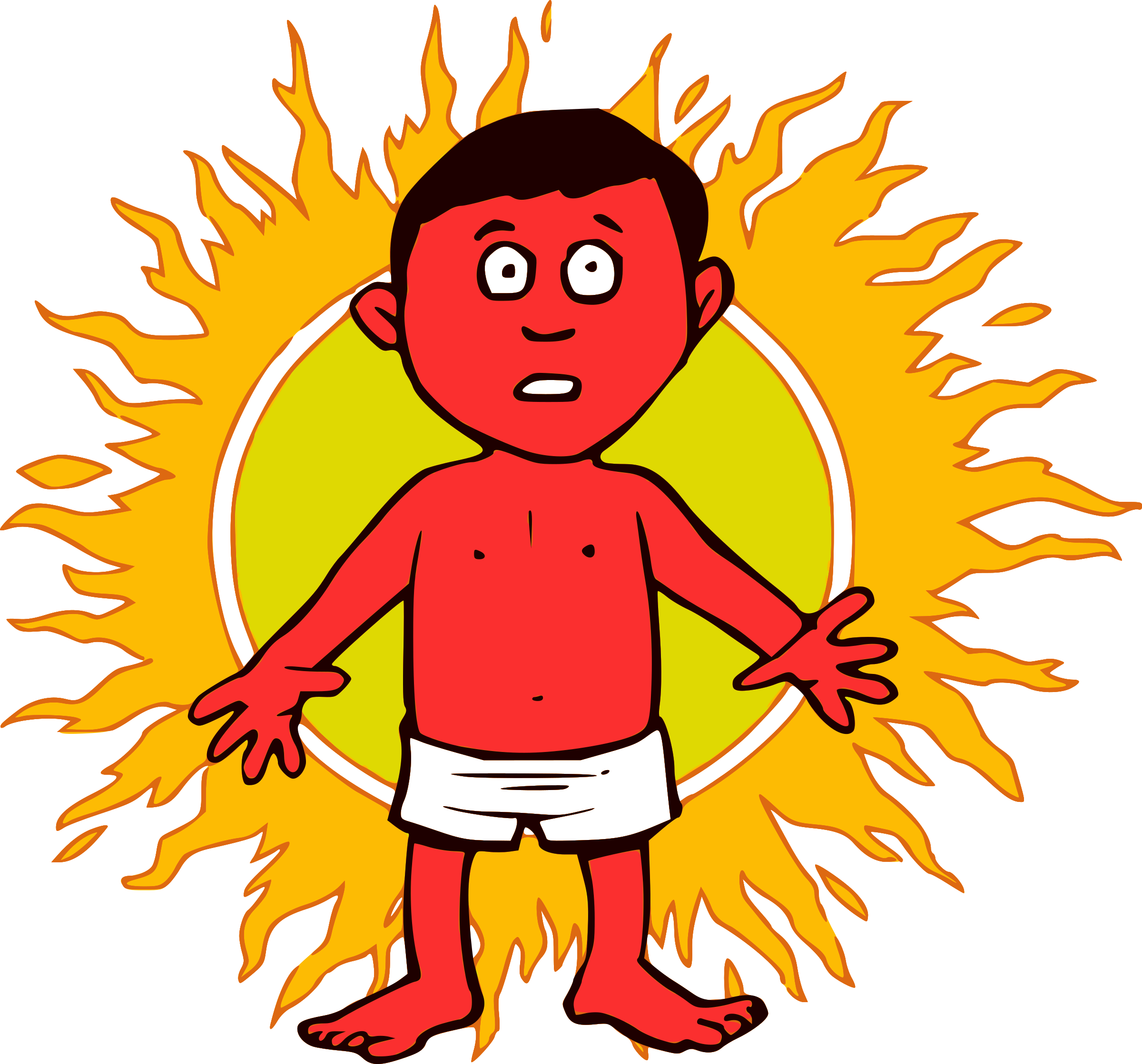 clipart sunburn clipart sunburn