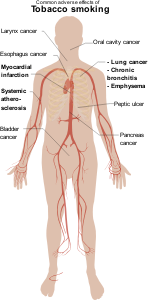 openclipart圖庫：Adverse Effects Of Tobacco Smoking