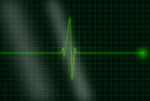 openclipart圖庫：electrocardiograms