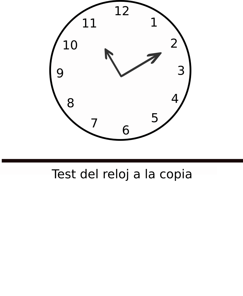 Test del reloj