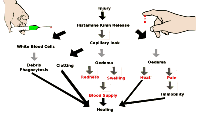 inflammation