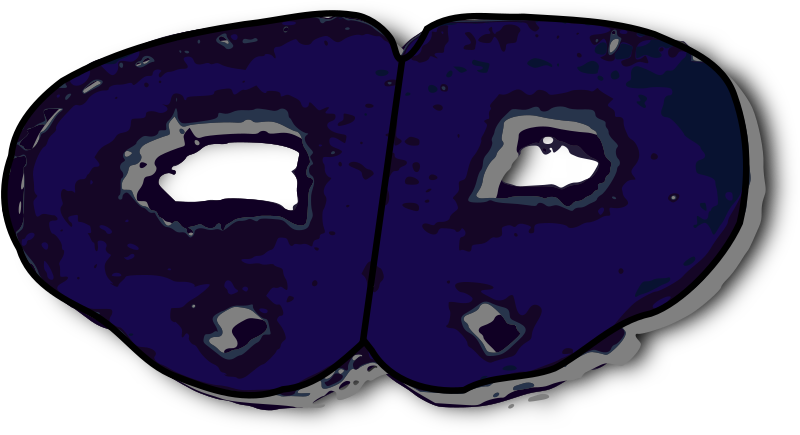 Coronal Section Rat Brain