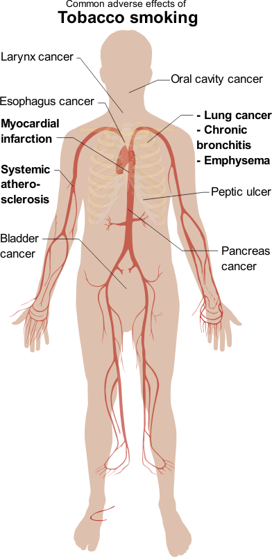 Adverse Effects Of Tobacco Smoking