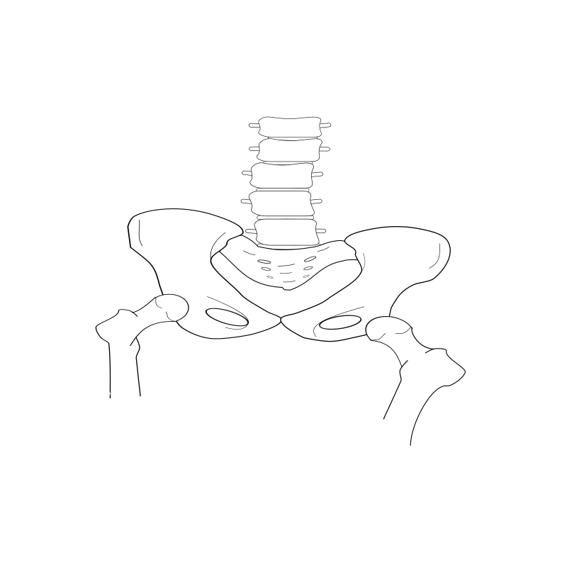 scoliosis pelvic