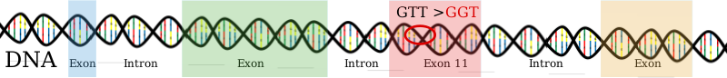 GIST in Exon 11 - DNA Mutation