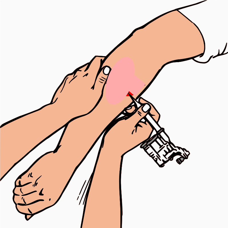 Getting An Arm Tattoo (Remix)