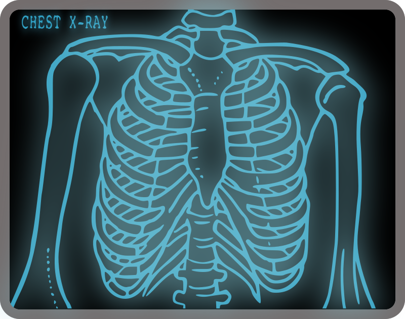 x ray clipart