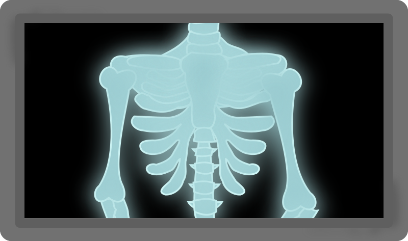 x ray skeleton cartoon