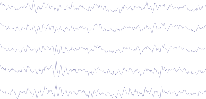 EEG Activity