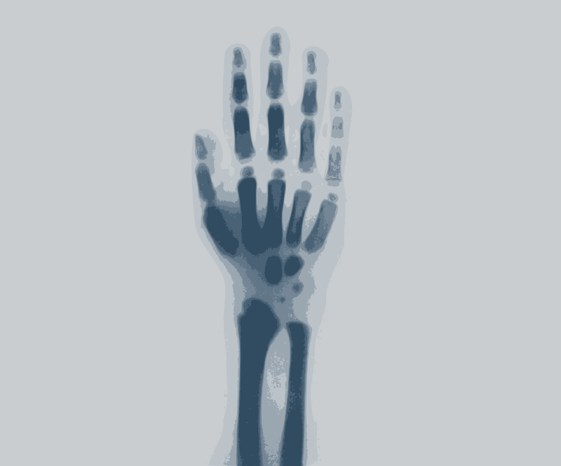 hand x ray clipart