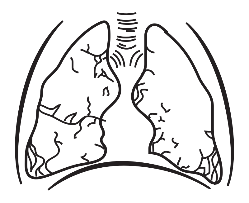 Lungs without Coloring