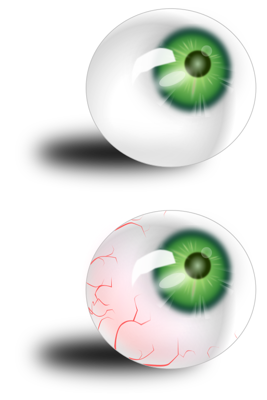 Eyeball green & bloodshot